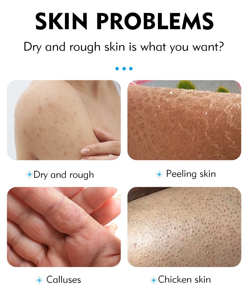 40% Urea Cream plus Salicylic Acid 2%, Anti-Cracking Nourishing and Moisturizing Hand and Foot Cream,Softens Cuticles on Rough Skin of Hands and Feet,3.05 OZ