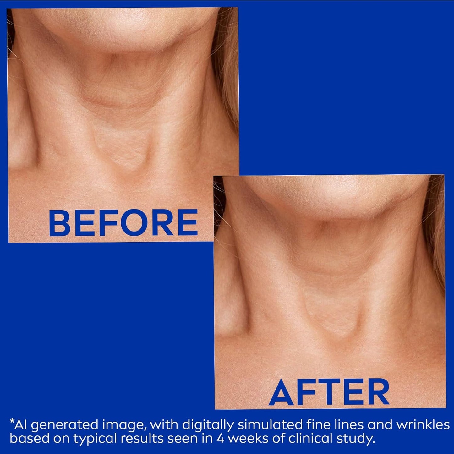 NIVEA Skin Firming & Anti Wrinkle Neck & Chest Cream with Coenzyme Q10, Creatine and Provitamin B5, Skin Firming Cream Reduces the Look of Fine Lines and Wrinkles, 6.7 Oz Tube