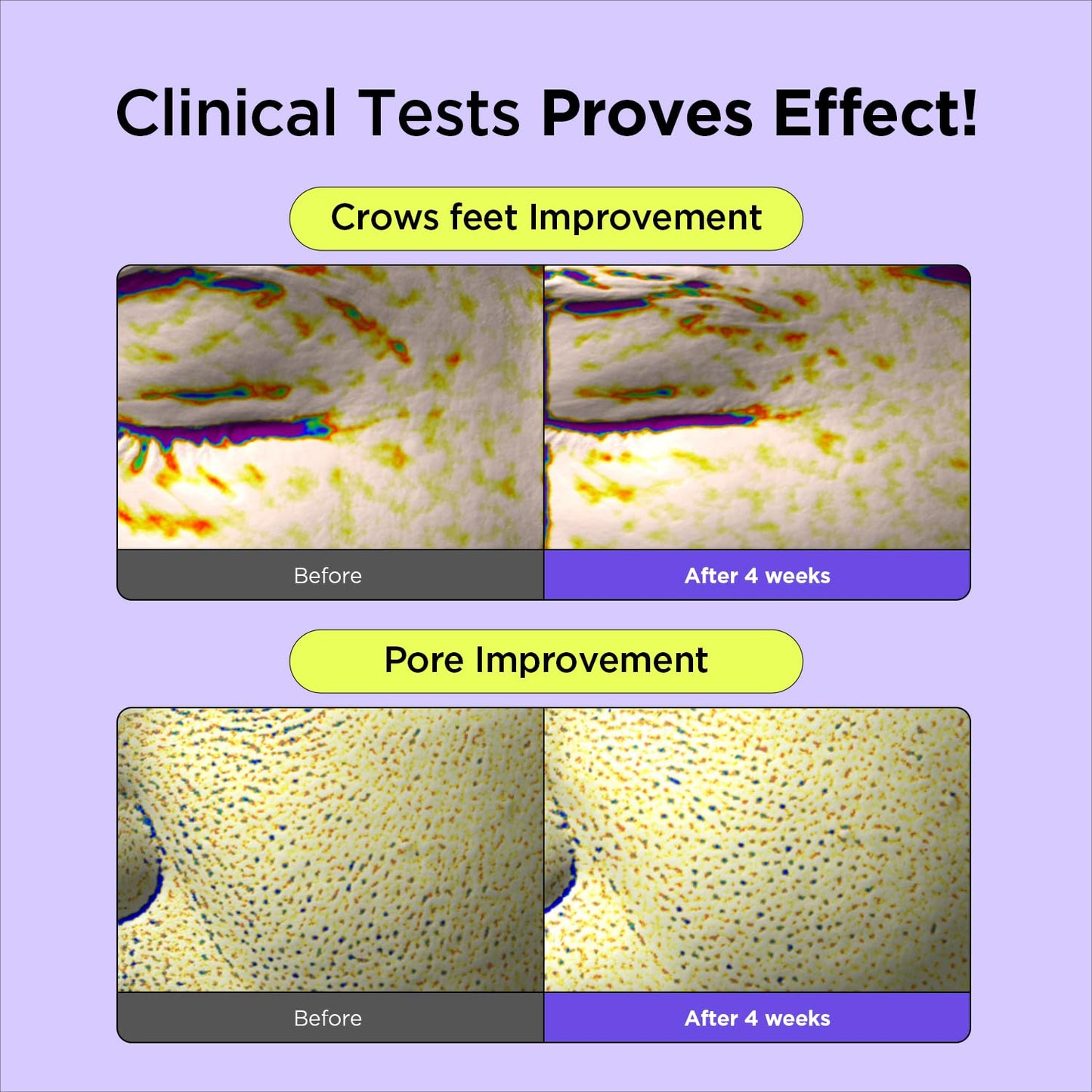 BY WISHTREND Vitamin A-mazing Bakuchiol Night Cream | Retinal, Peptide, Collagen, Ceramide NP, Centella Asiatica, moistfully plump overnight skincare (1.05 Ounce (Pack of 1))