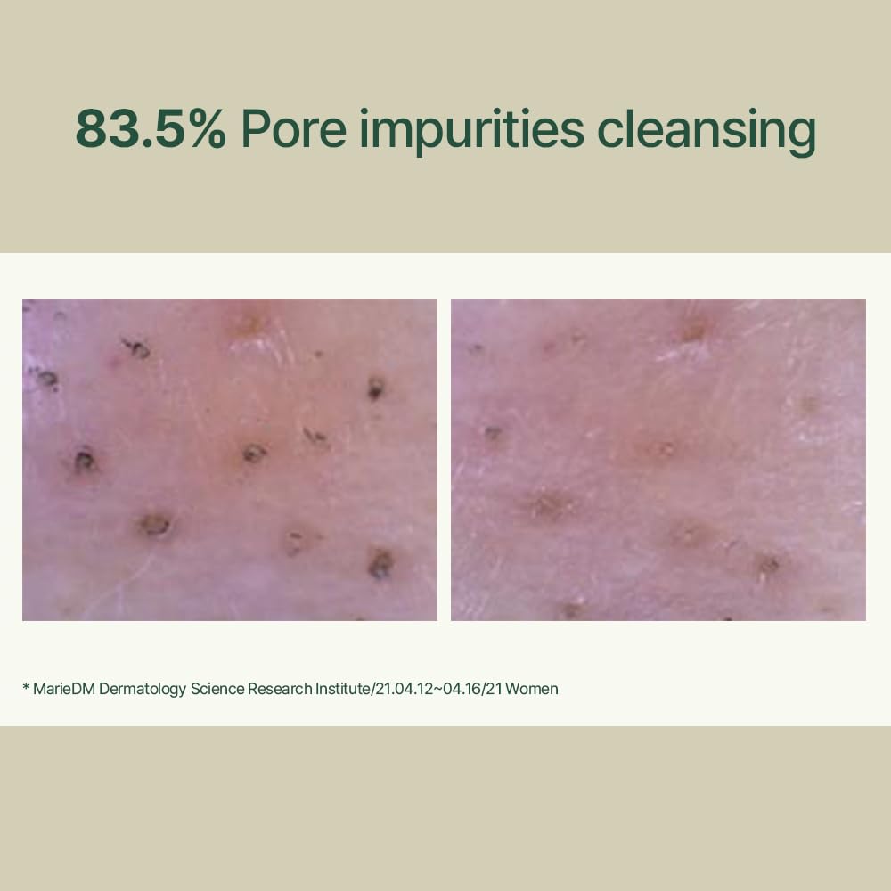 Pyunkang Yul PKY Calming Low pH Foaming Cleanser | Daily Face Wash & Makeup Remover with Tea Tree, Centella Asiatica, 5 Hyaluronic Acids that Removes Dead Skin Cells, Hydrates Skin - 150ml 5.07 Fl.Oz.