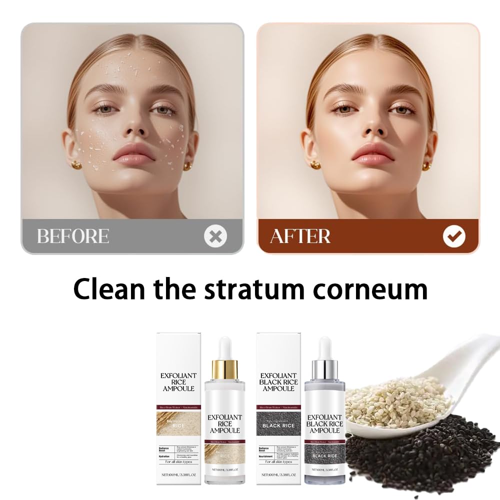 Black and White Rice Peeling, New Soft Rice Exfoliating Face and Body, Black and White Rice Exfoliant for All Skin Types, Gentle Peel & Deep Hydration (White+Black) 2pcs