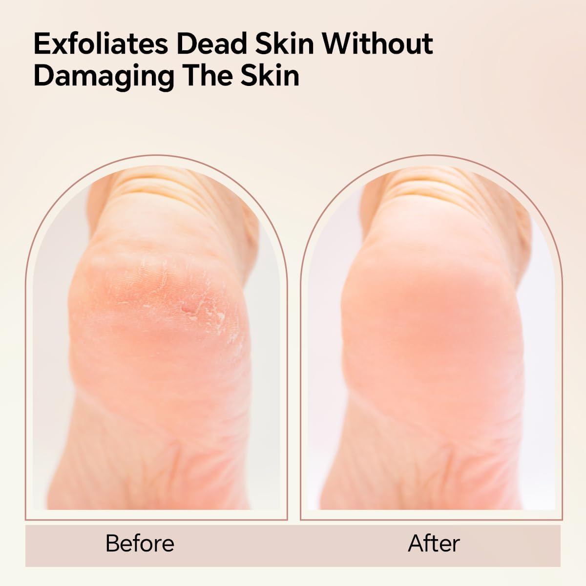 Nano Glass Foot File, Foot Callus Remover, Double Sided Pedicure Tools for Feet, Dual Use of Dry and Wet, Professional Hygienic Foot Scrubber to Achieve Smooth, Silky Feet Instantly (Coral Red)