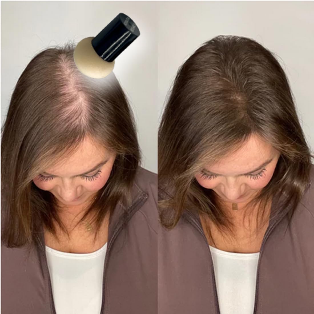 KERATIN RESEARCH Hairline Filler Unisex Mineral Powder Root Touch-Up Hair loss Concealer Scalp & Beard Bald Patch Coverage Fibers for Thinning Hair Waterproof Organic Natural look (MEDIUM BROWN, XL)