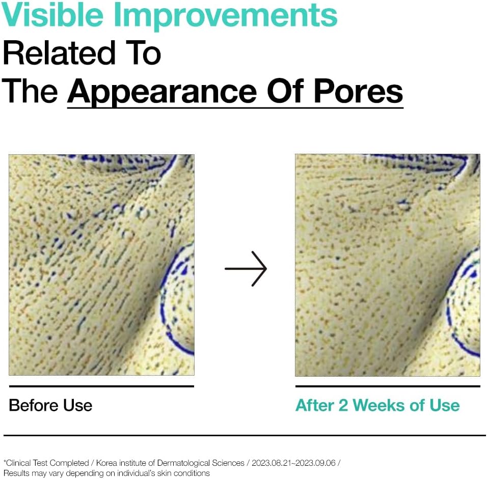 ANUA BHA 2% Gentle Exfoliating Toner, Mild Facial Exfoliant, Salicylic Acid for Pores and Sebum, Teatree Extract, Hyaluronic Acid, Ceramides (150ml / 5.07 fl.oz.)