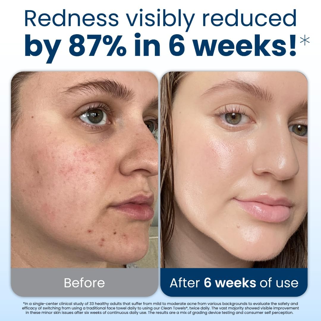 Clean Skin Club Clean Towels XL®, 100% USDA Biobased Face Towel, Disposable Face Towelette, Eczema Association Accepted, Makeup Remover Dry Wipes, Ultra Soft, 50 ct per pack, 4 Packs, 200 Ct Total