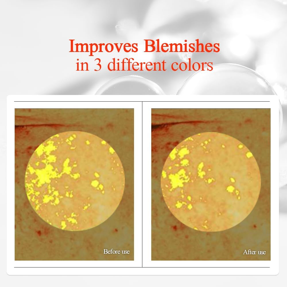 Pyunkang Yul PKY Radiance Vita Toner for Flawless and Radiant Skin, Blemish Care Toner with Vitamin C & Niacinamide, Zero Irritation, Korean Skincare (5.07 Fl. Oz, 150ml)