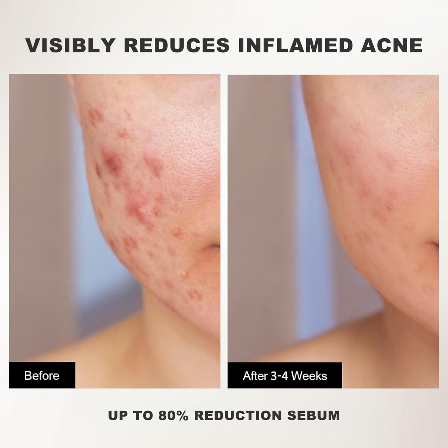 Peel Shot White Rice Peeling Ampoule - Soft Exfoliating Face and Body Scrub - Rice Exfoliator for Face Dead Skin Remover for Body - Deep Pore Cleanser Facial Scrub Exfoliator for All Skin Types