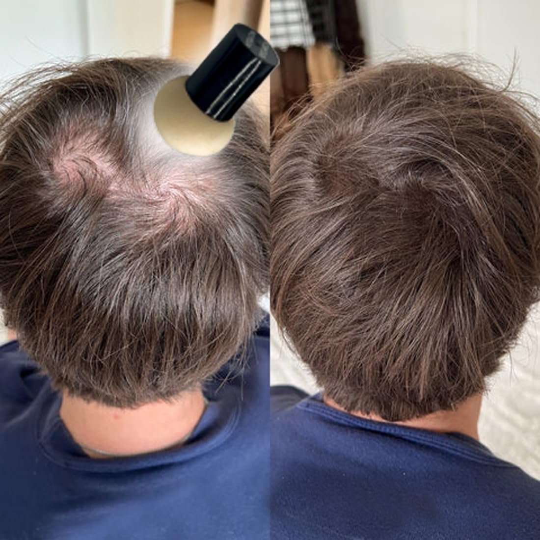 KERATIN RESEARCH Hairline Filler Unisex Mineral Powder Root Touch-Up Hair loss Concealer Scalp & Beard Bald Patch Coverage Fibers for Thinning Hair Waterproof Organic Natural look (WARM MED BROWN, XL)