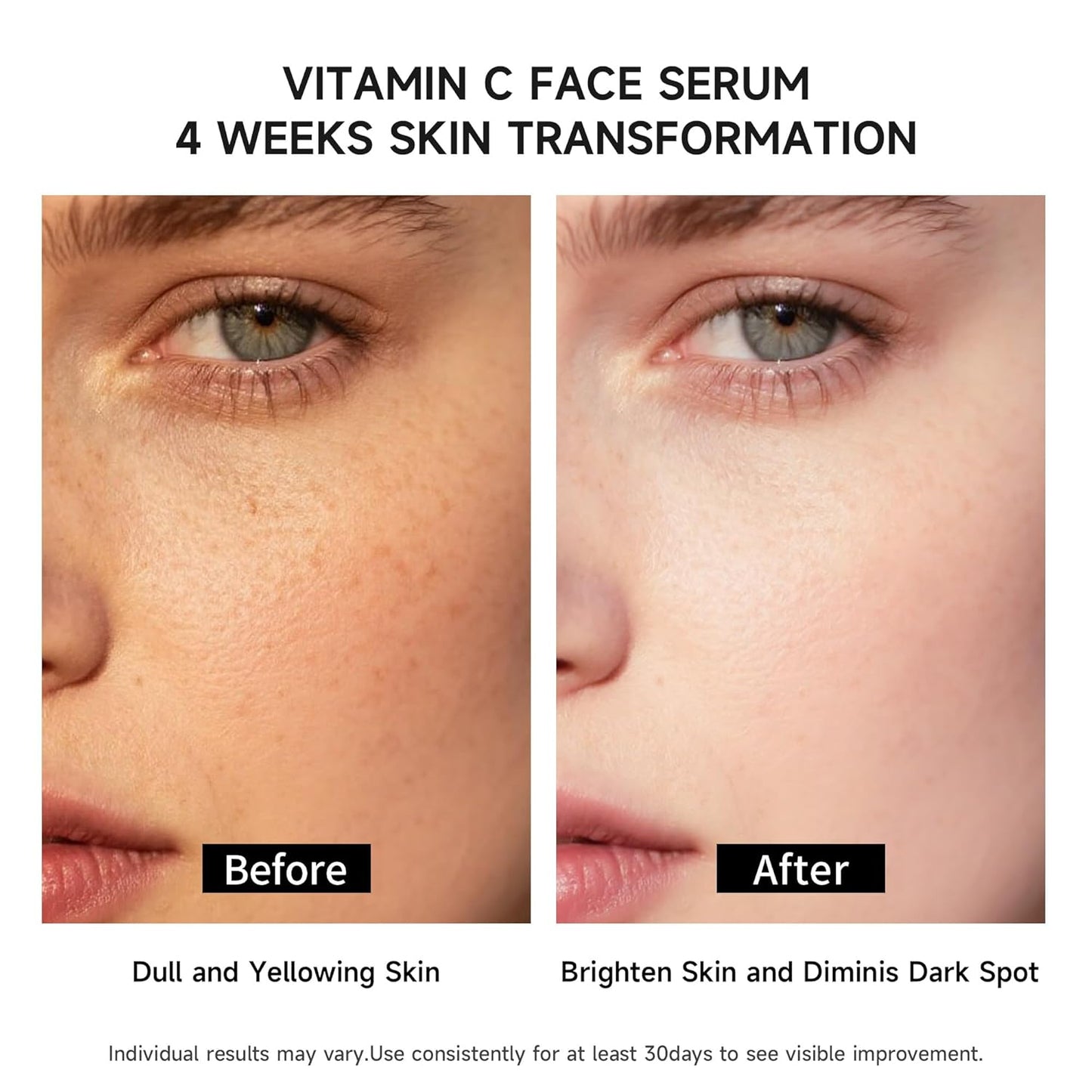 Vitamin C Face Serum with Glutathione, 4D Hyaluronic Acid & Aloe Vera – Lightweight Brightening & Hydrating Ampoule for Daily Skincare, Dark Spots, Sensitive Skin Friendly - 15 Ampoules (1ml each)