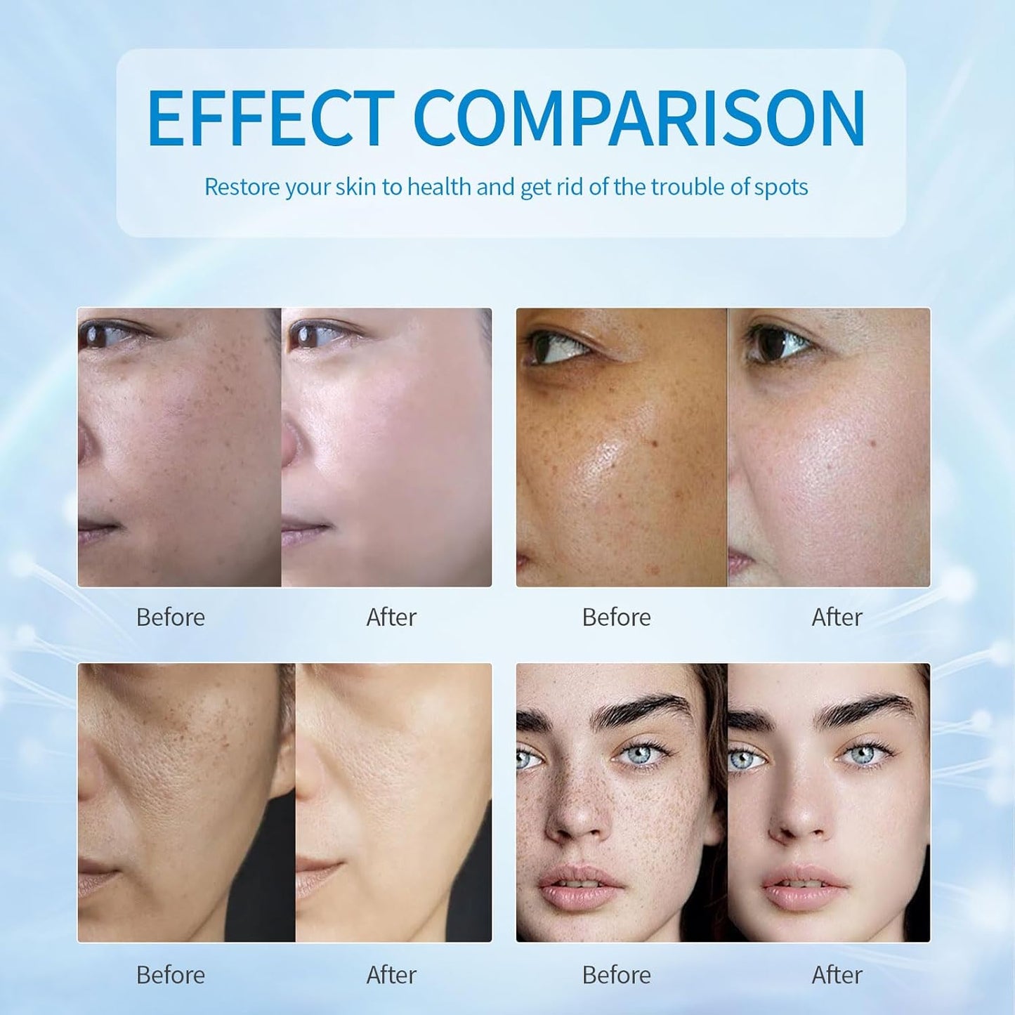 Dark Spot Remover for Face,Dark Spot Corrector, Dark Spot Serum for Sun Spots, Age Spots, Brown Spots,Acne Scars,Melasma Brown Spot -Advanced Formula with Niacinamide Retinol for Women (1.0 Fl Oz)