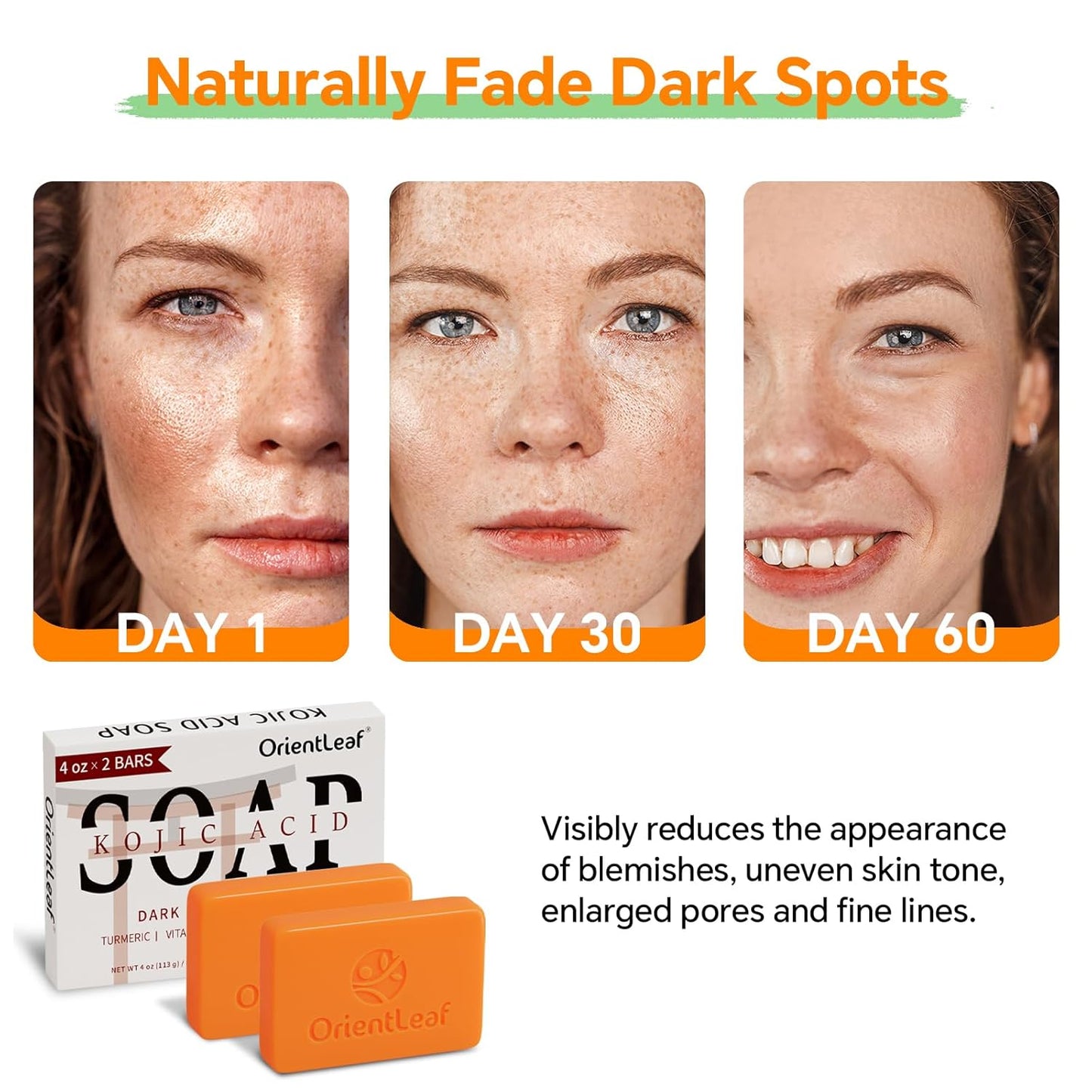 Kojic Acid and Turmeric Soap for Dark Spots Remover, Brightening, Hyperpigmentation for Face, 4oz x 2 BARS