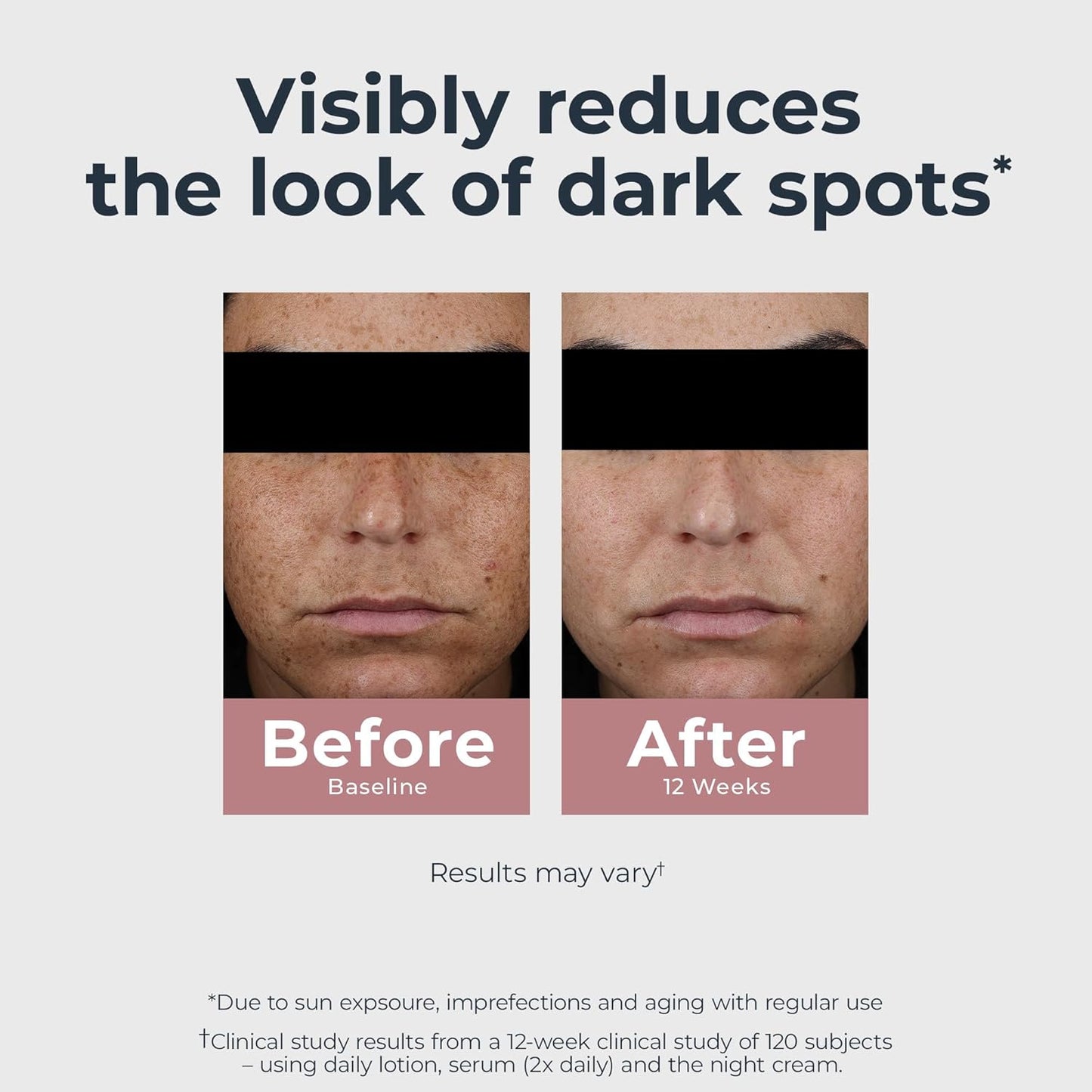 Eucerin Radiant Tone Night Cream, Dark Spot Corrector with Thiamidol, Night Moisturizer for Face Helps Visibly Reduce the Look of Persistent Dark Spots, All Skin Types, 1.7 Oz Bottle