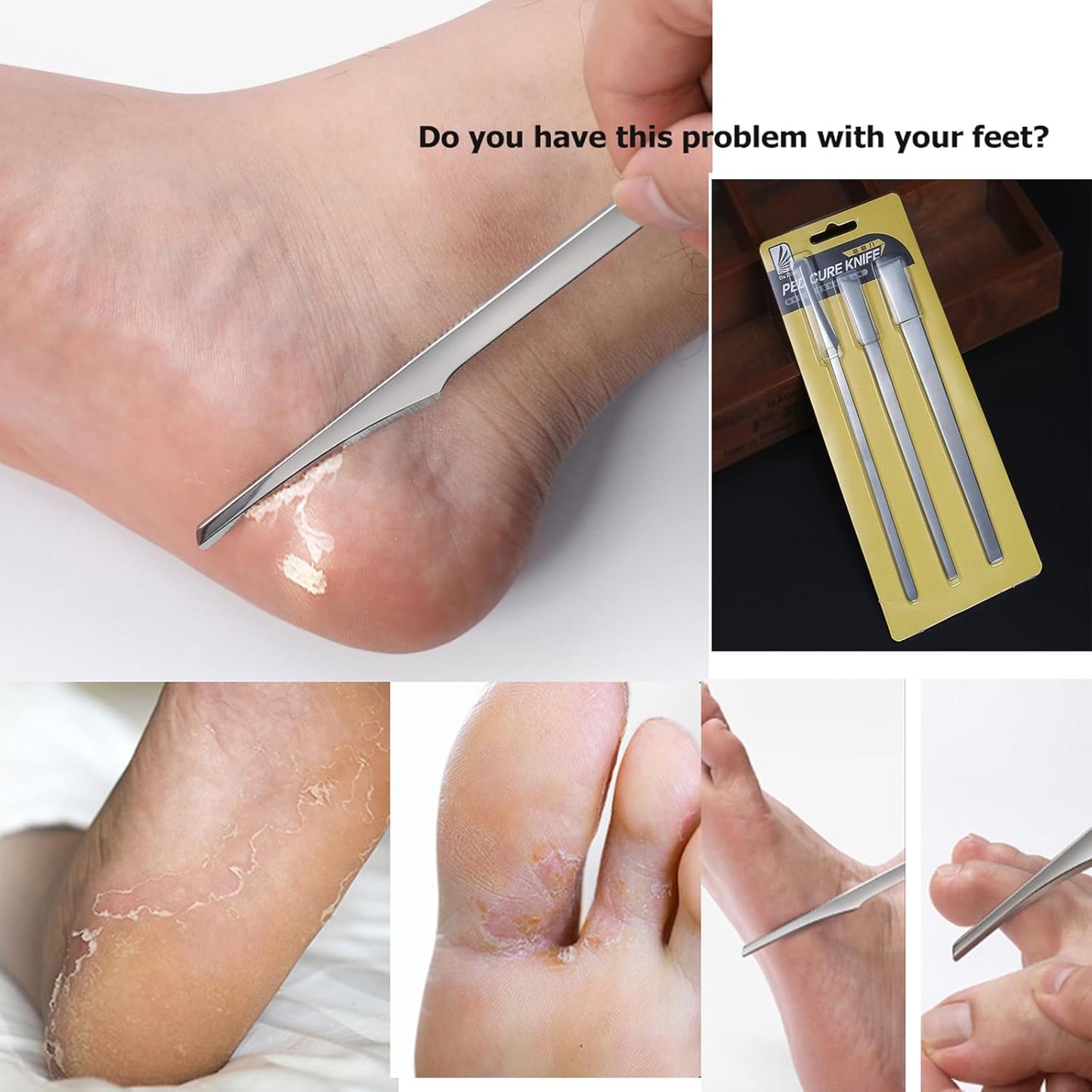 Stainless steel ingrown toenail pedicure knife set,professional foot skin scraper repair sharp blade kit for nail corn callus paronychia treatment. (3)