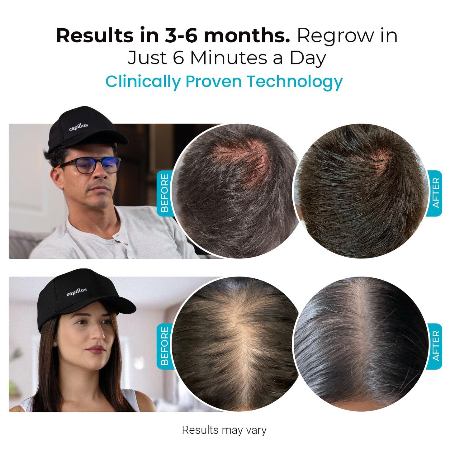 Capillus SPECTRUM Red Light Hair Therapy Hat, Laser Hair Growth Cap, Red Light Therapy for Hair Growth, Hair Red Light Therapy Red Light Cap Hair Regrowth 312 Low Level Laser Therapy + Bluetooth App