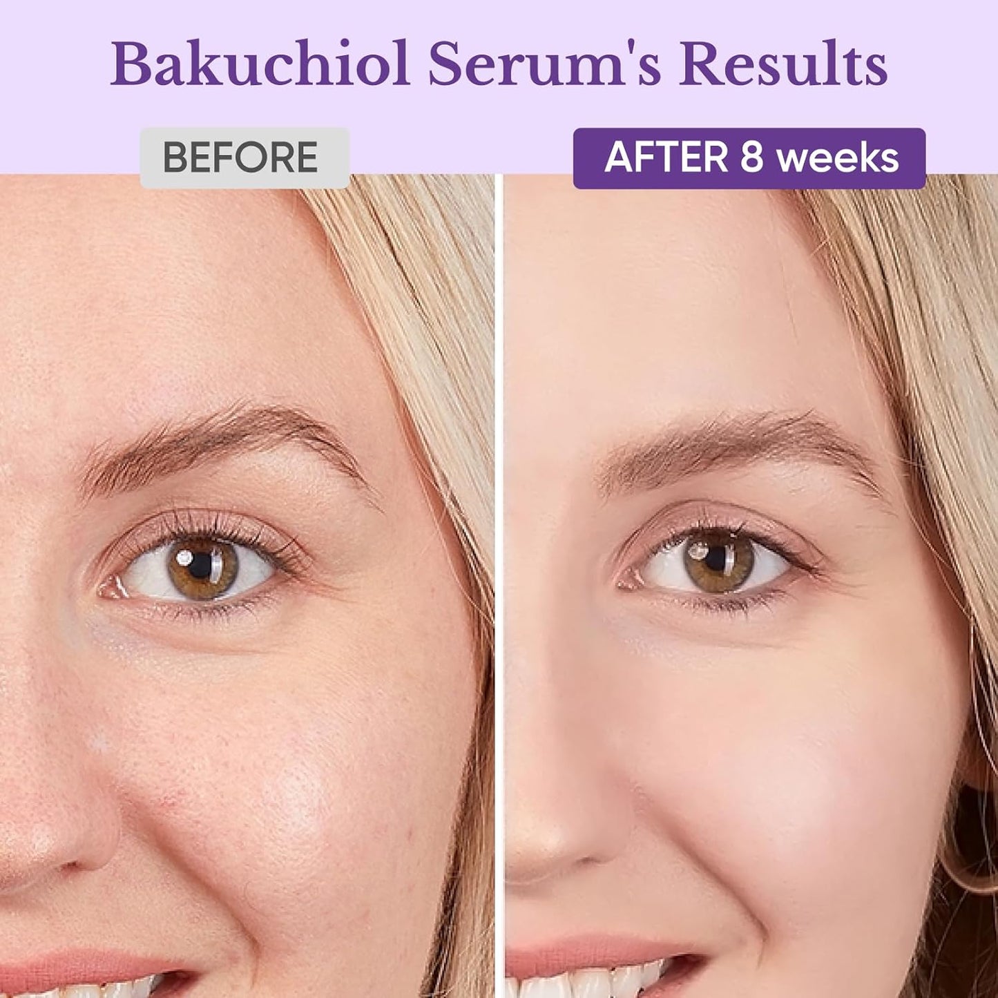 Bakuchiol Retinol Serum for Face, Retinol Alternative for Sensitive Skin with Vitamin E, Hyaluronic Acid, Collagen, Serum for Anti-Aging, Wrinkle Reduction Skin Firming & Smoothing 1 oz