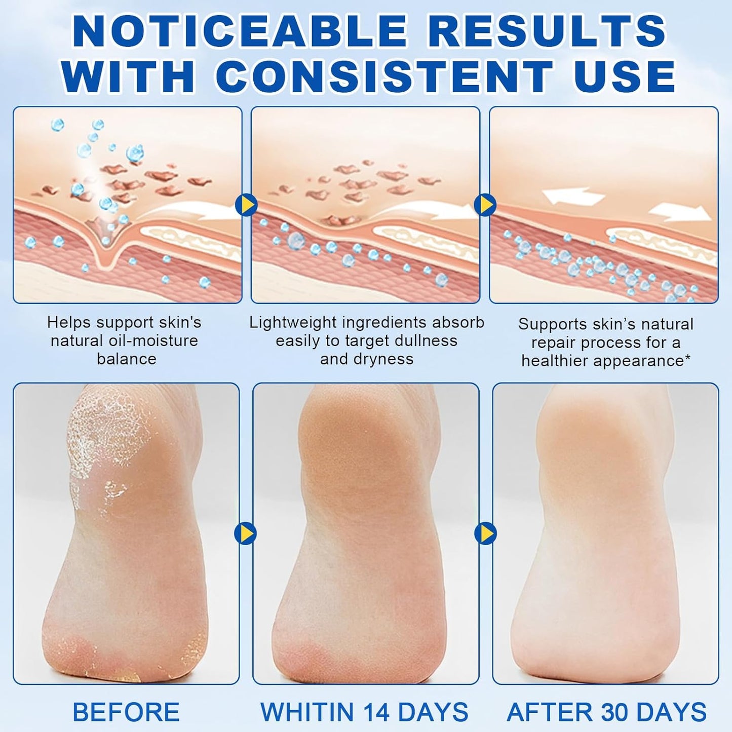 2Pack 60% Urea with 2% Salicylic Acid Urea Foot Care Stick, Foot Cream Moisturizer for Dry Cracked Feet, Knees, Elbows, Hands,Moisturizes and Hydrates the Dry Skin,Callus Remover & Skin Softener