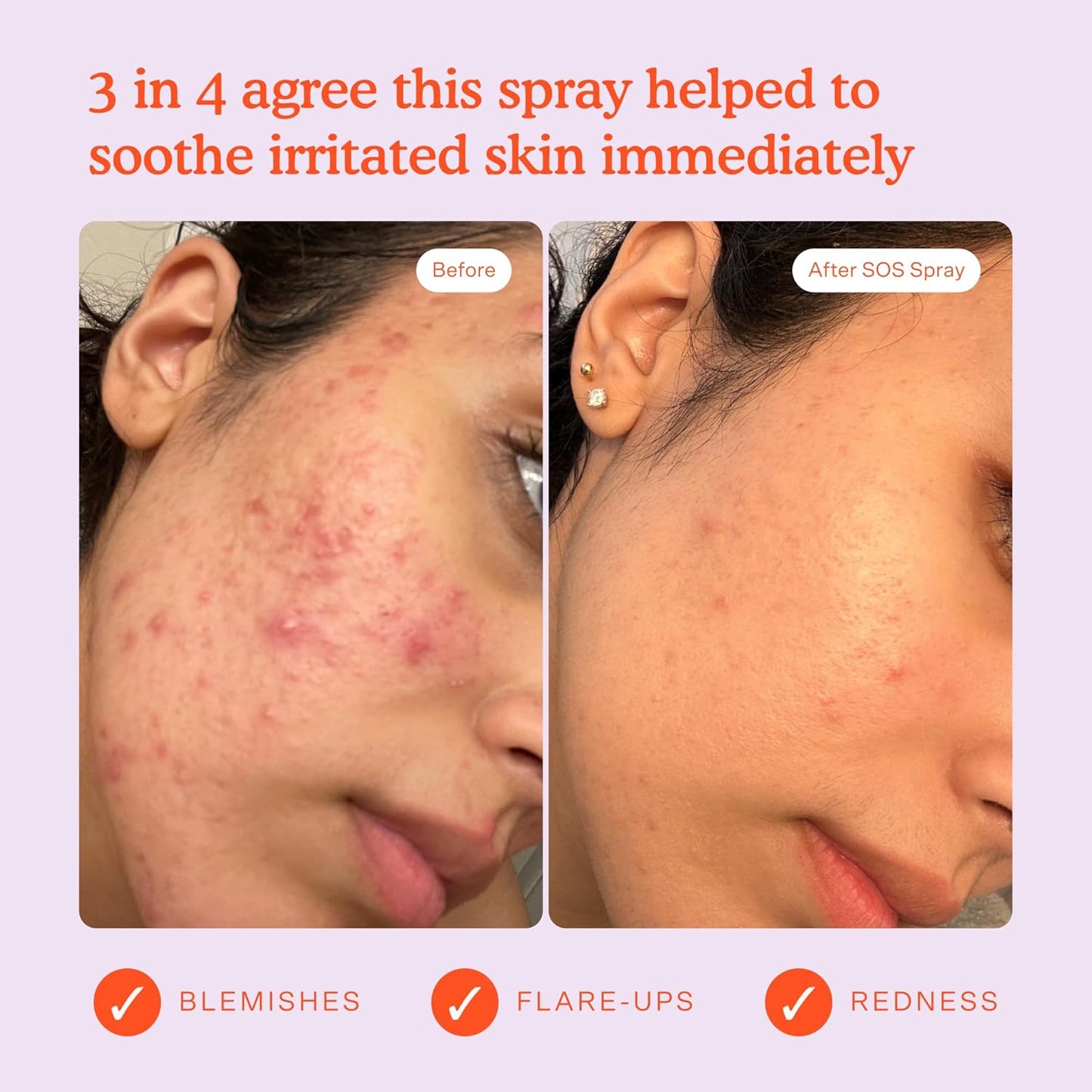 Tower 28 SOS Daily Rescue Facial Spray for Sensitive Skin, Hypochlorous Acid Spray Helps Visibly Reduce the Appearance of Redness and Breakouts, Travel Size Toner for Face, 1 FL Oz