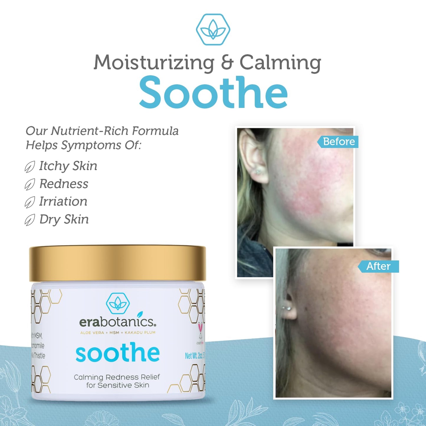 Era Organics Cream Redness Relief Moisturizer- Soothing Redness Relief for Face with Manuka Honey, MSM, Chamomile - Calming Moisturizer Made in USA