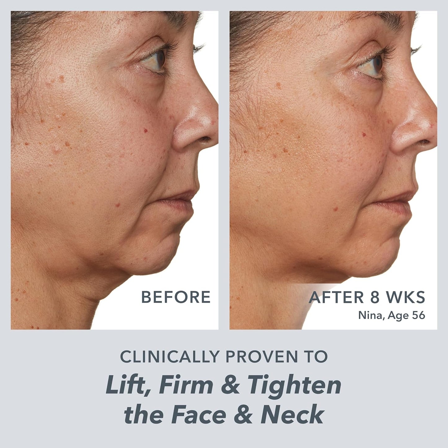 Beekman 1802 Milk RX Advanced Better Aging Face Cream - Mini - Goat Milk Protein Exosomes & Polypeptide Facial Moisturizer - Doctor Formulated for Collagen Boosting & Firming - Fragrance Free