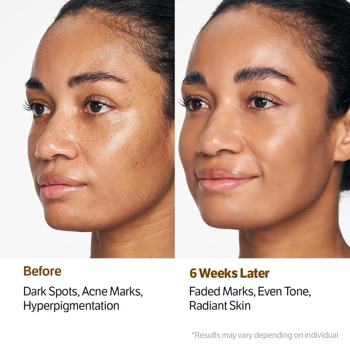 SUNGBOON EDITOR Kojic Acid Niacinamide Face Wash | Turmeric Cleanser for Dark Spots & Radiance | Korean Skin Care with Hyaluronic Acid | Gentle Makeup Remover & Blackhead Cleanser