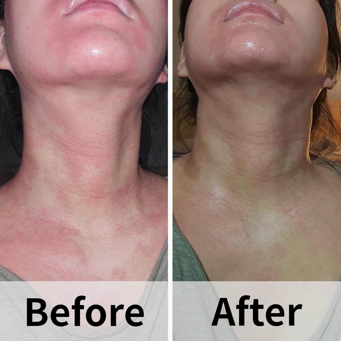 Ato Fast Calming Serum for Sensitive & Eczema-Prone Skin Instant Relief from Itch, Redness & Flare-Ups Powered by Cica & Panthenol 1.69 Fl Oz