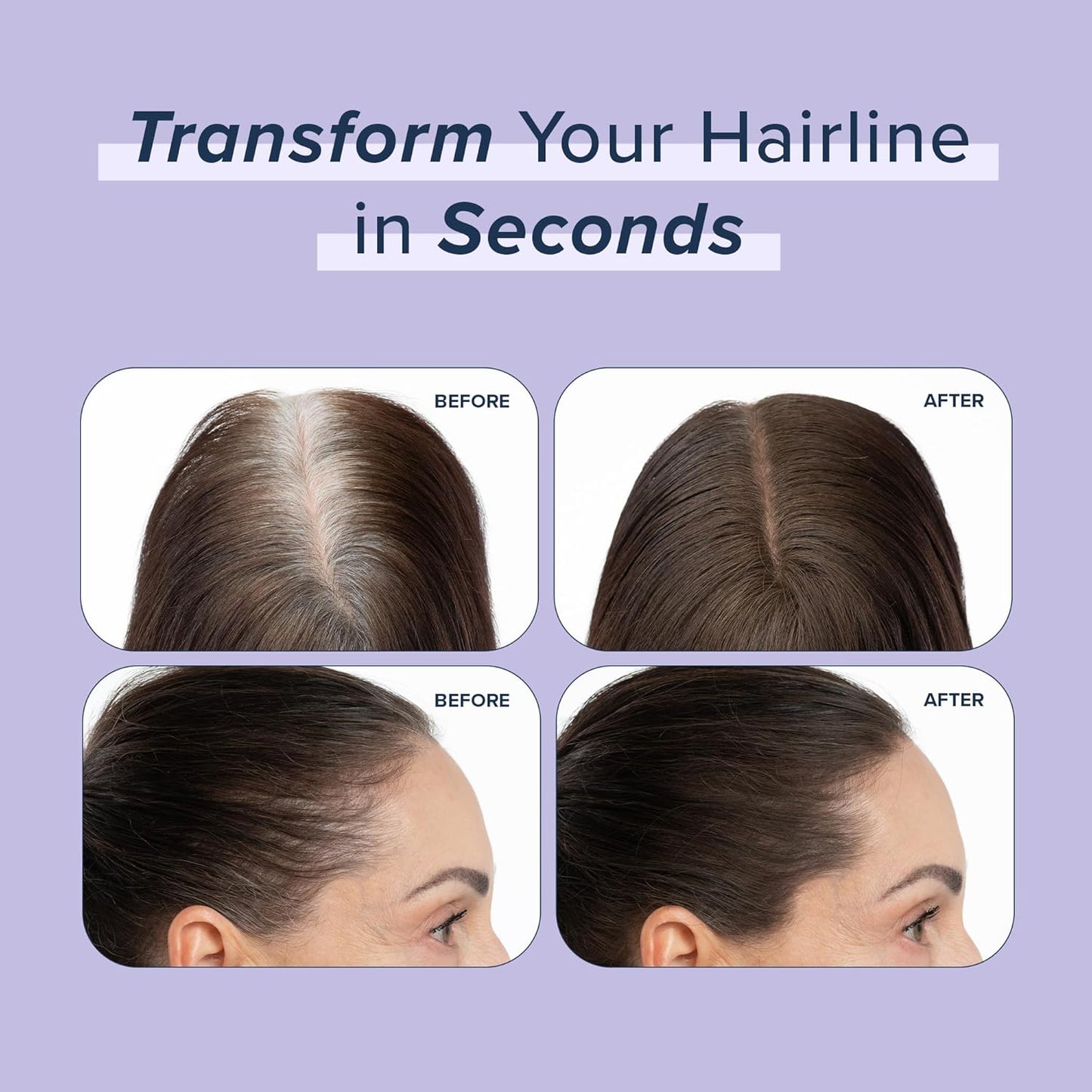 TRUHAIR Root & Scalp Cover Up Pressed Powder Compact, Waterproof, Weightless Hair Coverage & Bald Spot Concealing, Root Touch Up Hair Color for Gray Coverage & Thinning Areas, 0.35 Oz (Dark Brown)