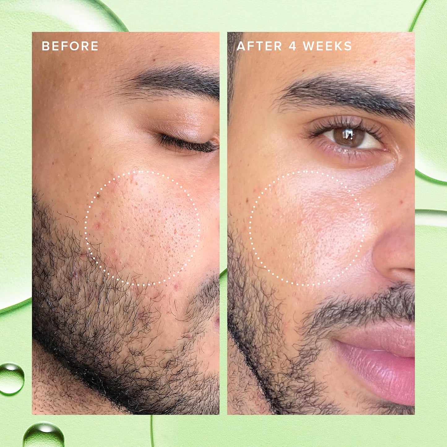 Farmacy 2% Salicylic Acid Toner for Face - Deep Sweep Gentle BHA Exfoliant for Oily Skin - Refines Texture with Papaya Enzymes & Moringa Water for a Healthy-Looking Complexion (120ml)