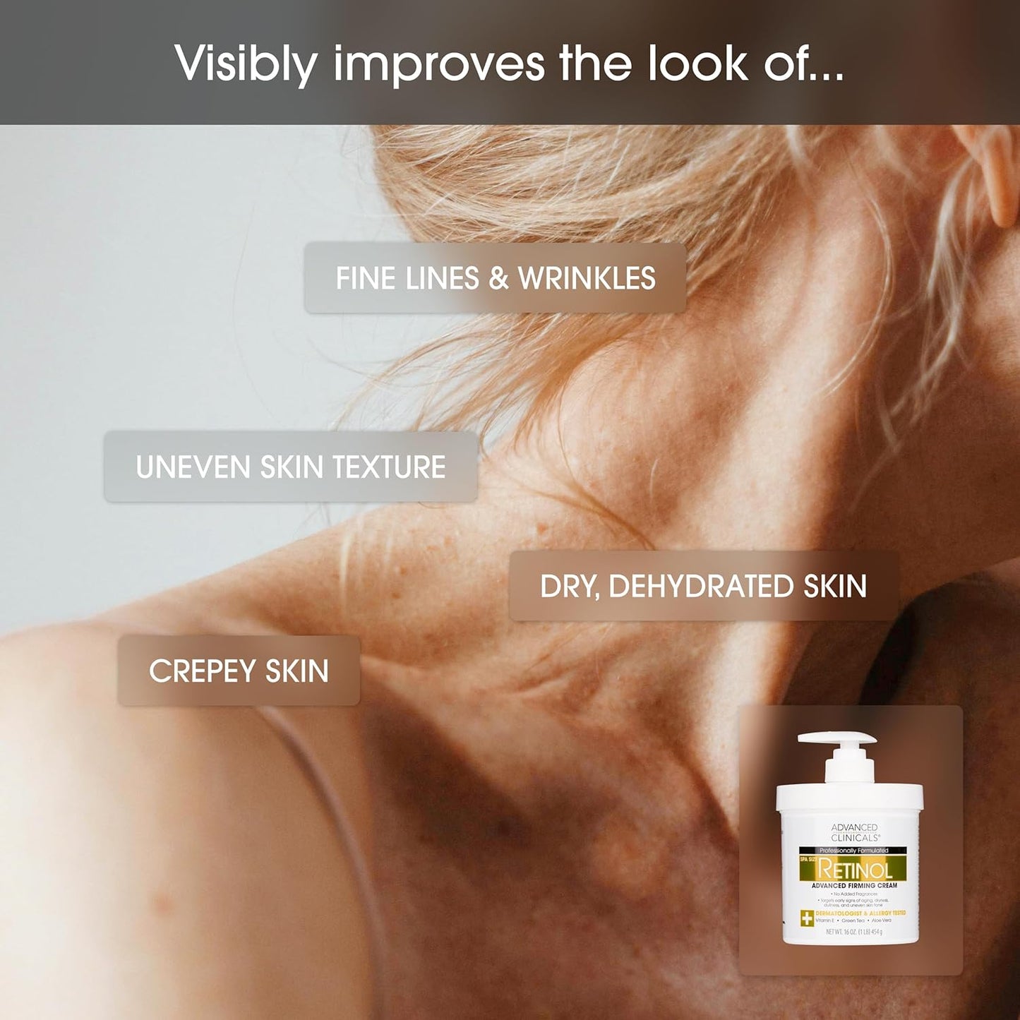 Advanced Clinicals Retinol Body Lotion & Face Moisturizer | Visible Anti Aging Skin Care Retinol Body Cream For Women & Men Targets Look Of Fine Lines, Wrinkles & Crepe Looking Dry Skin, 16OZ, 2-Pack