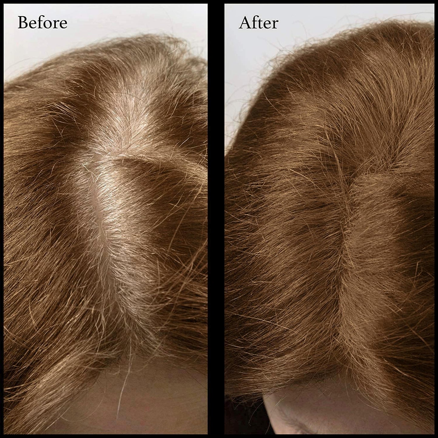 Root Touch Up Powder - 11 True-to-Nature Shades - Zero Fragrance, Talc or Parabens - Hairline Concealer by NuBeauti (Without Brush, Warm Brown)