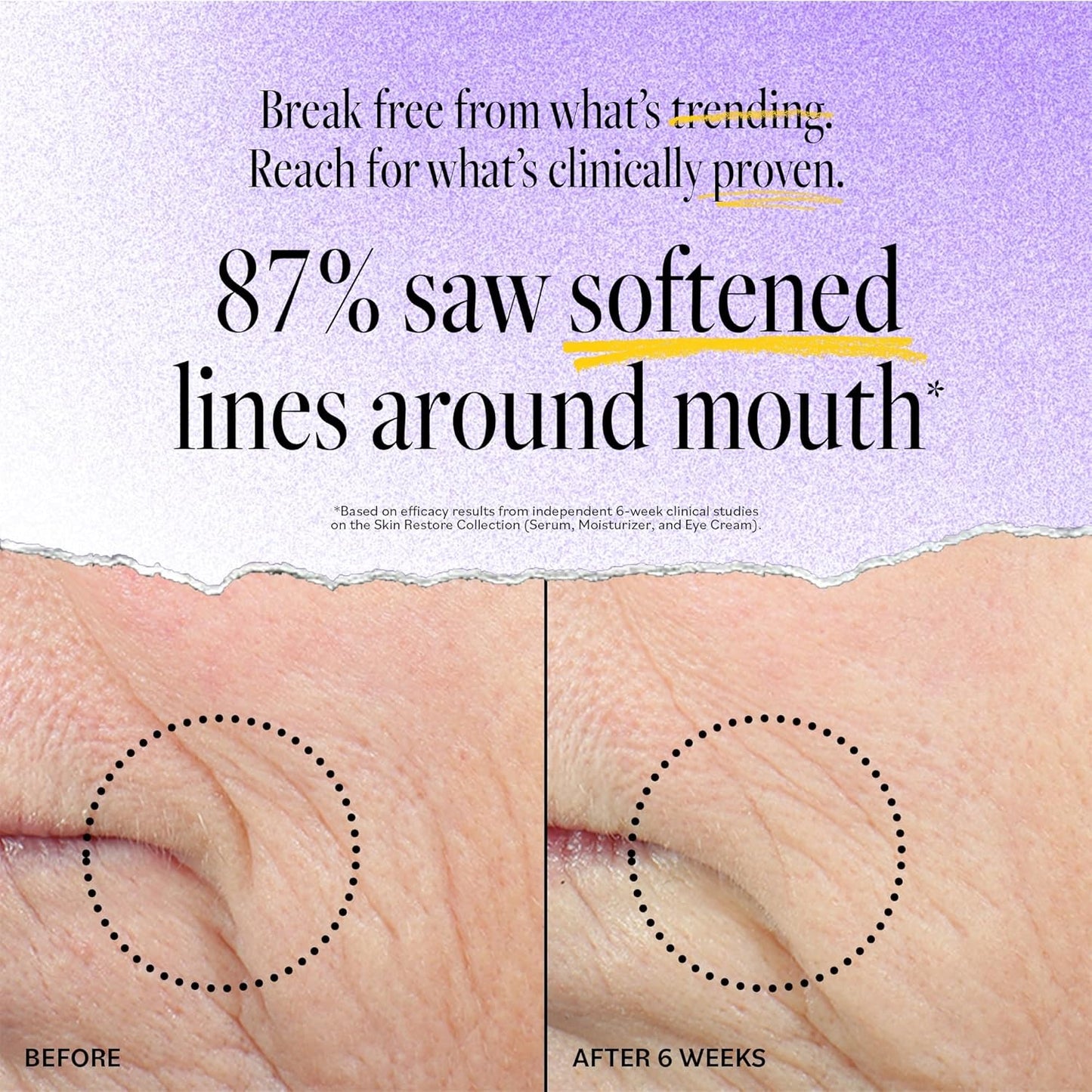 DERMA E Advanced Peptides and Vegan Flora-Collagen Serum – Double Action Collagen Face Cream with Peptide Complex – Intensely Hydrating Serum for Lines, Wrinkles and Redness, 2 oz